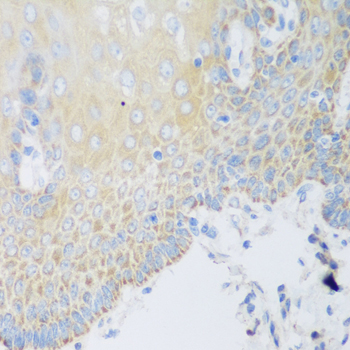 DHODH Rabbit polyclonal antibody