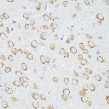 DHODH Rabbit polyclonal antibody