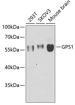 GPS1 Rabbit polyclonal antibody