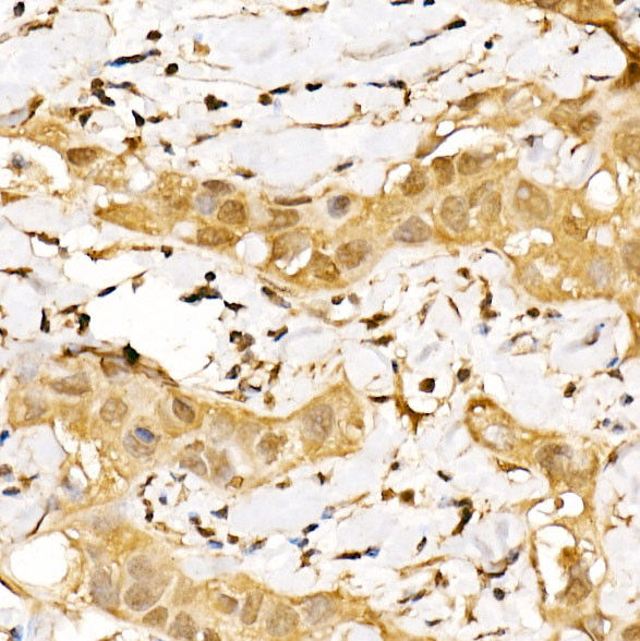 GPS1 Rabbit polyclonal antibody