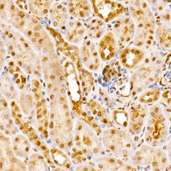 GPS1 Rabbit polyclonal antibody