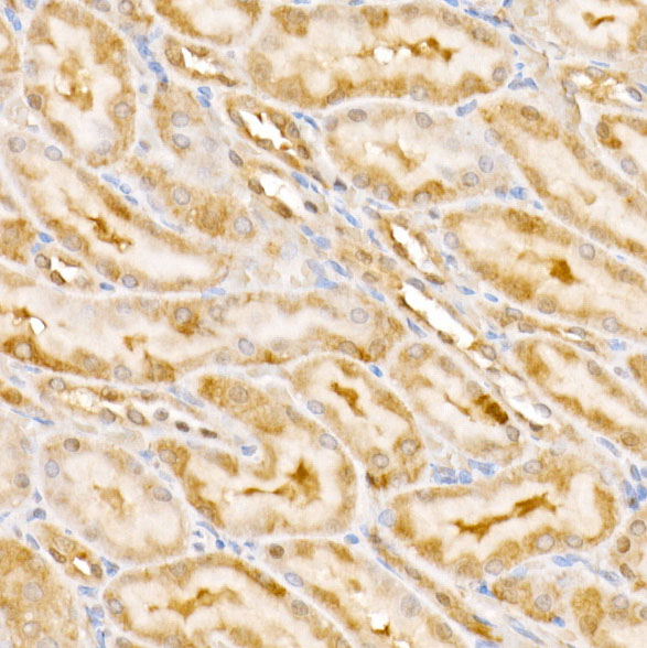 GPS1 Rabbit polyclonal antibody