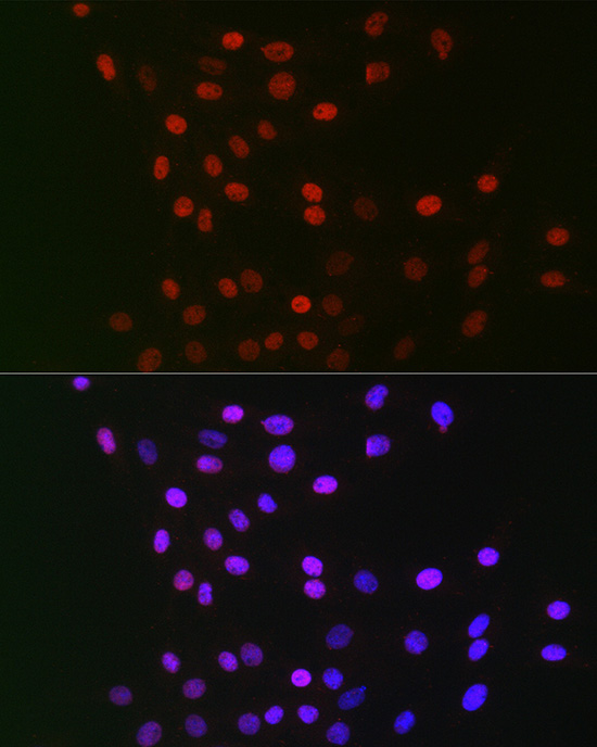 GPS1 Rabbit polyclonal antibody