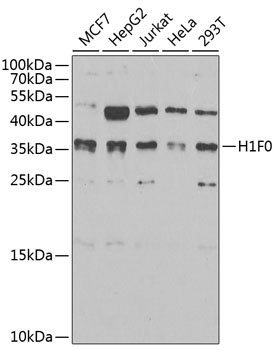 Histone H1.0 Rabbit pAb