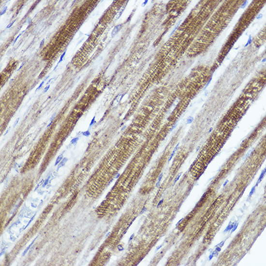 KCND3 Rabbit polyclonal antibody