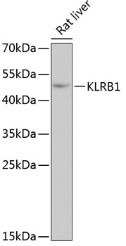 KLRB1 Rabbit polyclonal antibody