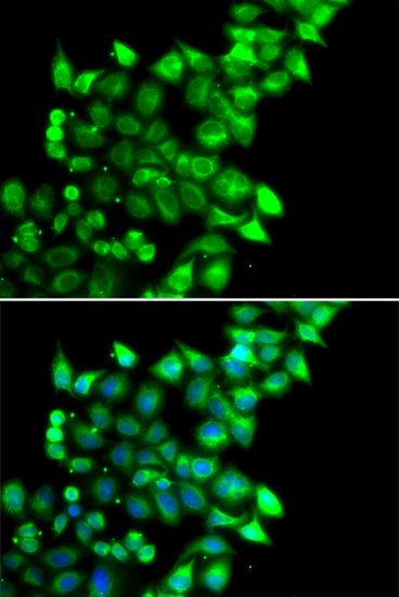 MEST Rabbit polyclonal antibody