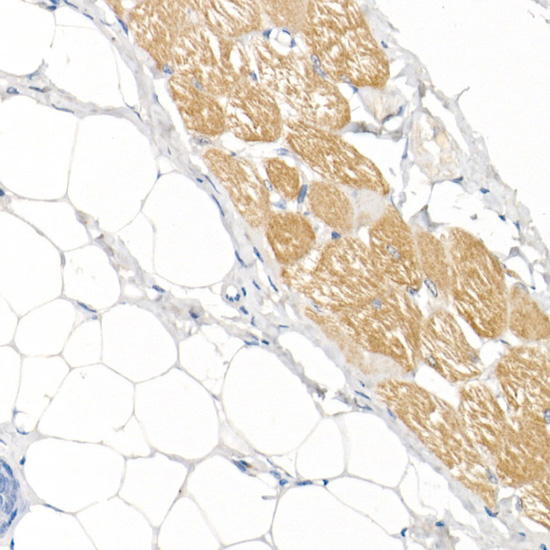 MYH1 Rabbit polyclonal antibody