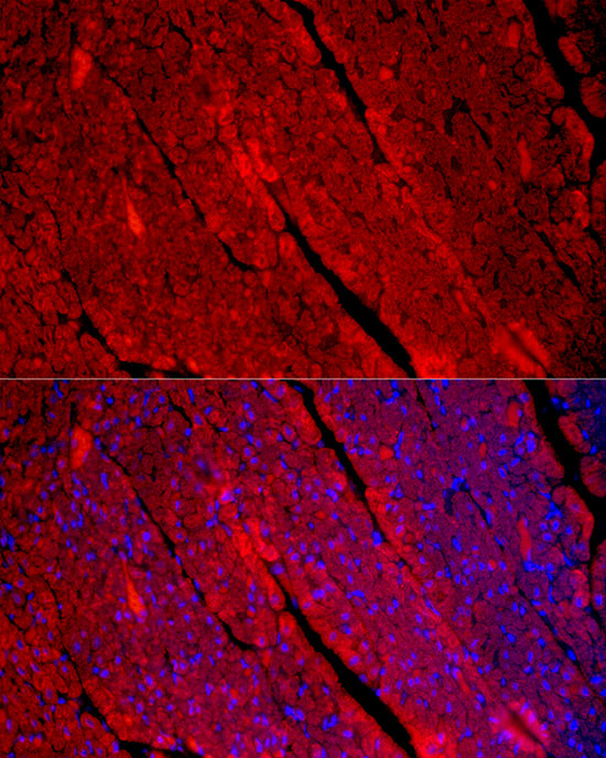 MYH1 Rabbit polyclonal antibody