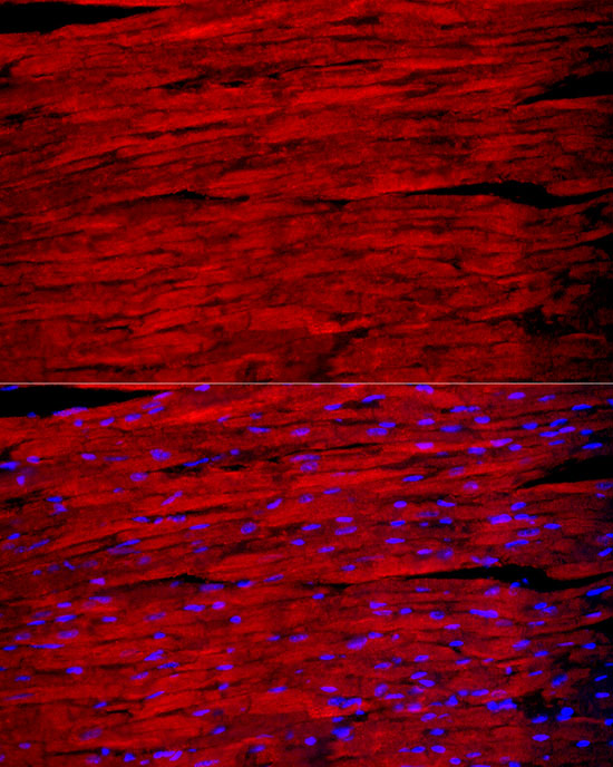 MYH1 Rabbit polyclonal antibody