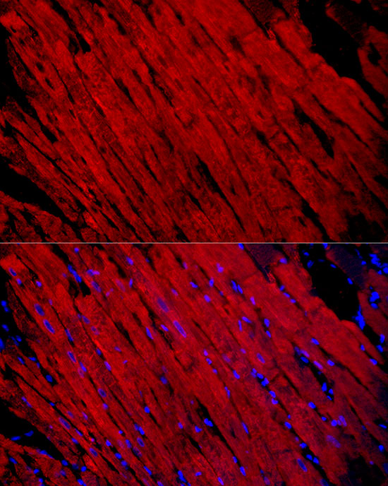 MYH1 Rabbit polyclonal antibody
