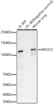 MYO1C Rabbit polyclonal antibody