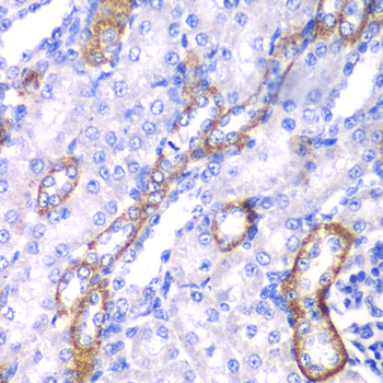 MYO1C Rabbit polyclonal antibody