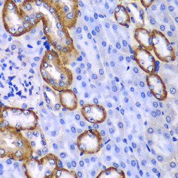MYO1C Rabbit polyclonal antibody
