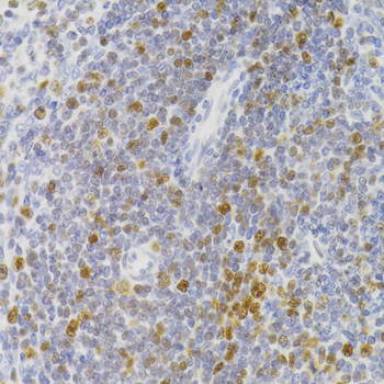 NASP Rabbit polyclonal antibody