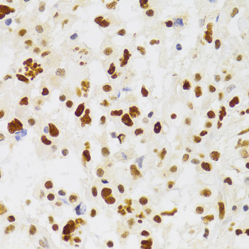 NASP Rabbit polyclonal antibody