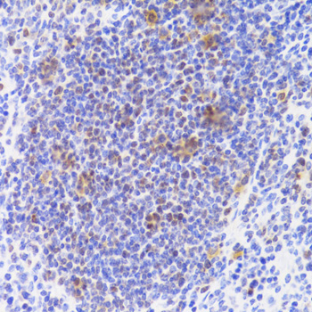 NASP Rabbit polyclonal antibody