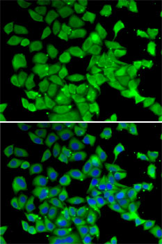 PARN Rabbit polyclonal antibody
