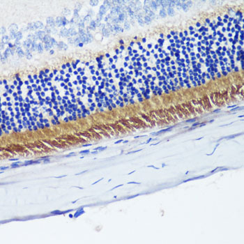 PDE6B Rabbit polyclonal antibody