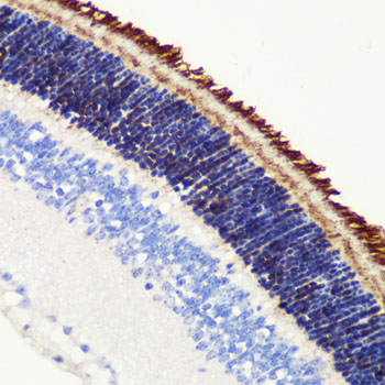 PDE6B Rabbit polyclonal antibody