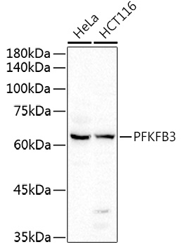 PFKFB3 Rabbit polyclonal antibody