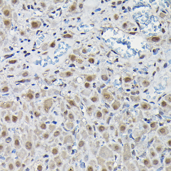 PFKFB3 Rabbit polyclonal antibody