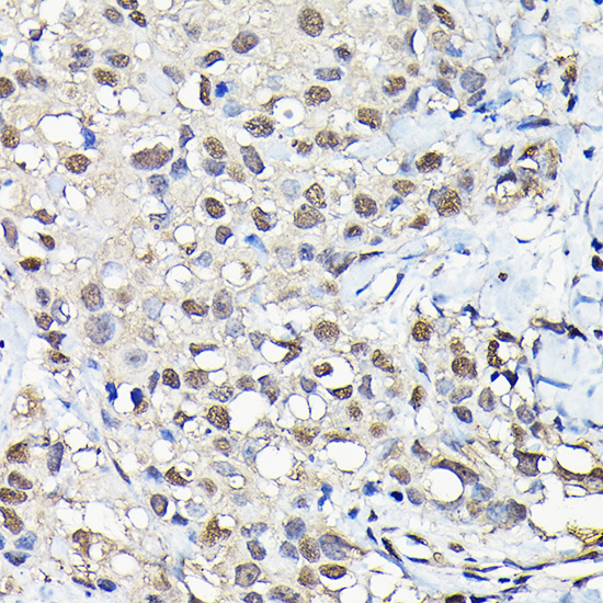PFKFB3 Rabbit polyclonal antibody