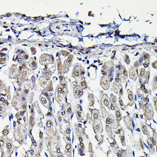 PFKFB3 Rabbit polyclonal antibody