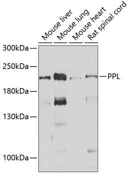PPL Rabbit polyclonal antibody
