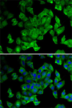PPL Rabbit polyclonal antibody