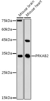PRKAB2 Rabbit polyclonal antibody