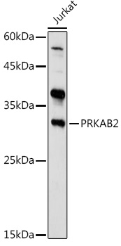 PRKAB2 Rabbit polyclonal antibody