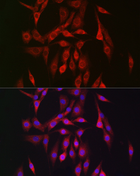 PRKAB2 Rabbit polyclonal antibody
