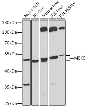 MEK5 Rabbit polyclonal antibody