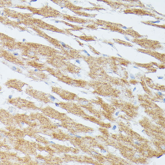 MEK5 Rabbit polyclonal antibody