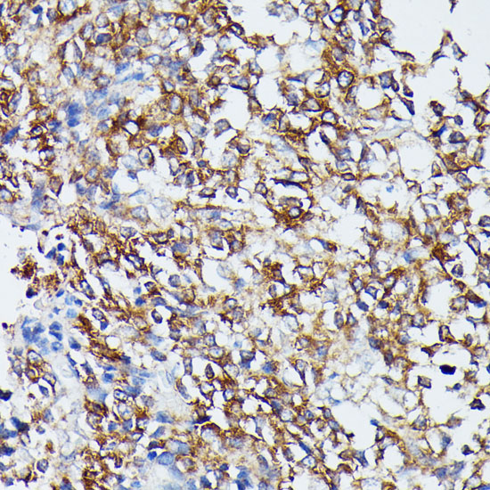 MEK5 Rabbit polyclonal antibody