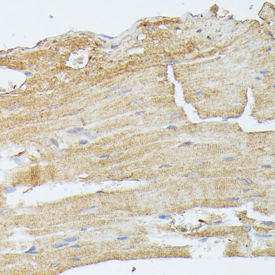 MEK5 Rabbit polyclonal antibody