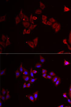 MEK5 Rabbit polyclonal antibody