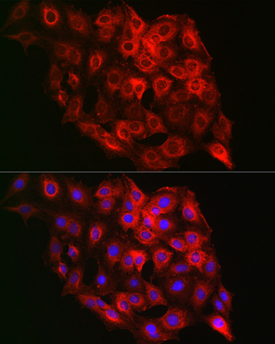 PSMD8 Rabbit polyclonal antibody