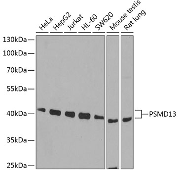 PSMD13 Rabbit polyclonal antibody