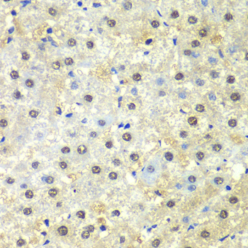 PSMD13 Rabbit polyclonal antibody