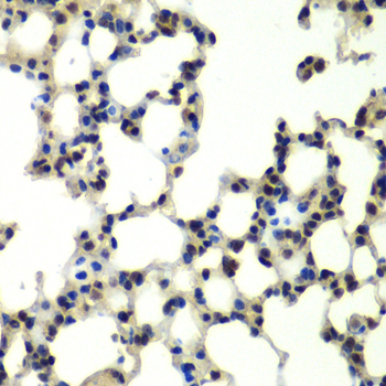 PSMD13 Rabbit polyclonal antibody