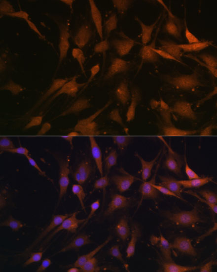 PSMD13 Rabbit polyclonal antibody