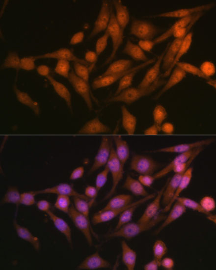 PSMD13 Rabbit polyclonal antibody