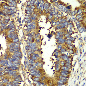 QARS Rabbit polyclonal antibody