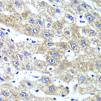 QARS Rabbit polyclonal antibody