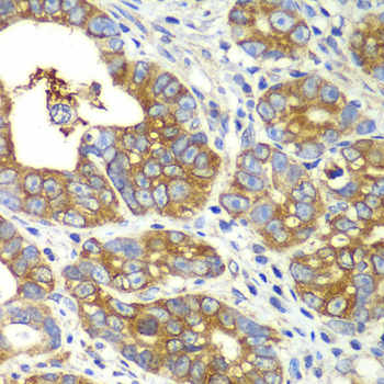 QARS Rabbit polyclonal antibody