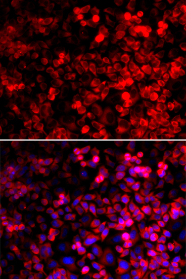 QARS Rabbit polyclonal antibody