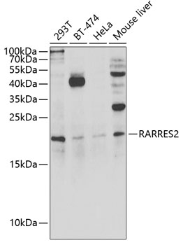 RARRES2 Rabbit polyclonal antibody