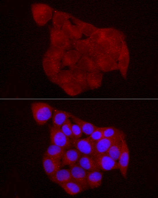 RARRES2 Rabbit polyclonal antibody